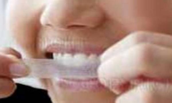 ممنوعیت های سفیدکننده های خانگی دندان